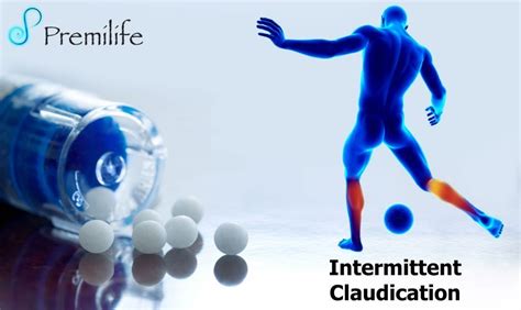 Intermittent Claudication | Premilife - Homeopathic Remedies