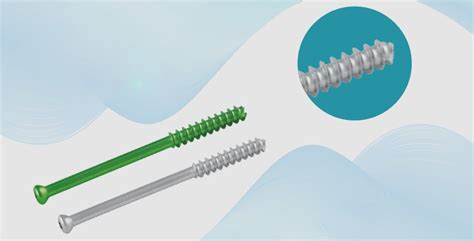 Cannulated Screw - What You Should Know