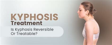 Kyphosis Treatment: Is Kyphosis Reversible Or Treatable?