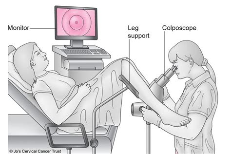 ABNORMAL PAP (CERVICAL SCREENING) TESTS