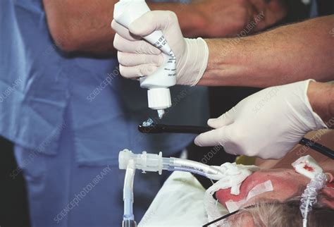 Heart valve surgery - Stock Image - M561/0057 - Science Photo Library