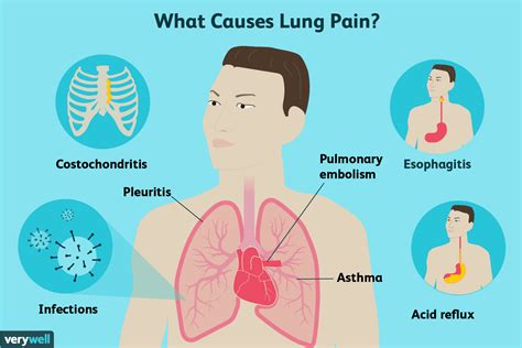 Everything To Know About Lung Cancer - CancerWalls