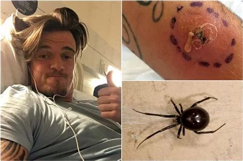 Former Boro youth player suffers horrific injuries after being bitten ...