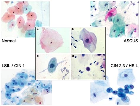 Pap Smear Cytology