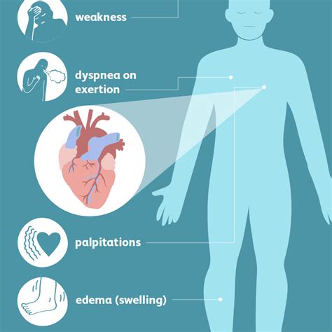 Pulmonary Edema (Symptoms, Diagnosis, Treatment, and Prevention ...