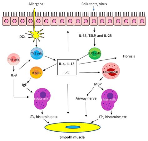 Cells | Free Full-Text | Current Understanding of Asthma Pathogenesis ...