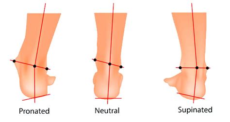 Supination explained | Sportsinjuryclinic.net