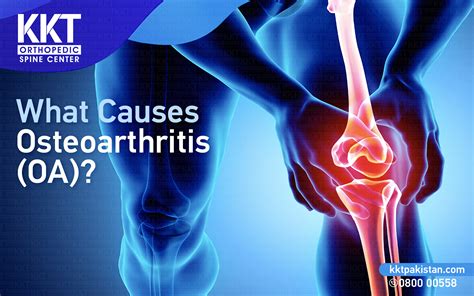 What causes Osteoarthritis? - KKT Pakistan | Pakistan's Only Non ...