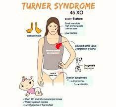 turner syndrome genotype Archives - Samarpan Physiotherapy Clinic