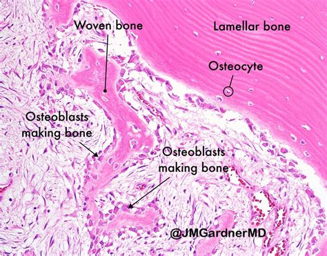 Osteoblasts Histology