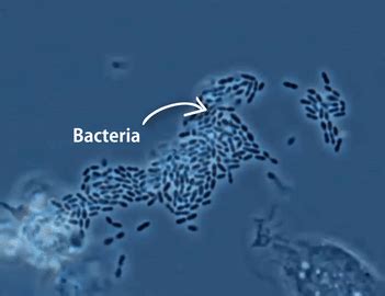 Bacteria Phagocytosis by Macrophage - MEDizzy