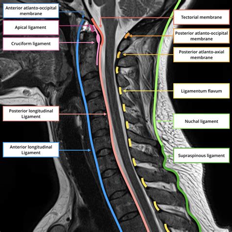 Mri Cervical Spine Anatomy | Images and Photos finder