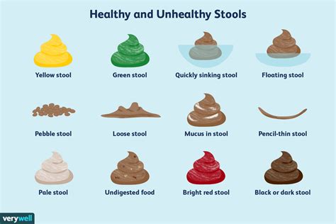 Colon Cancer Stool Color Chart