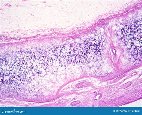 Histology of Epiglottis Human Tissue Stock Image - Image of science ...