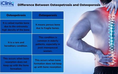 What Is Osteopetrosis?