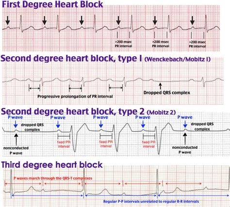 ECG – ProductiveMedic