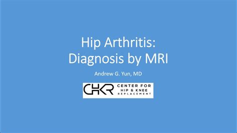 X-Ray vs MRI in the Diagnosis of Hip Arthritis - YouTube