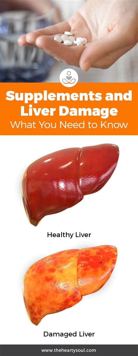 Liver Damage from Supplements is On the Rise, Scientists Say | Liver ...