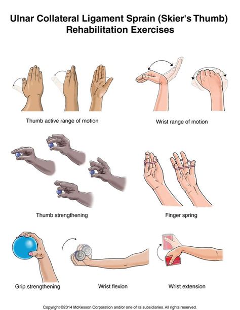 Summit Medical Group - Skier's Thumb (Ulnar Collateral Ligament Sprain ...