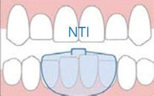 NTI – Westside Dental Group