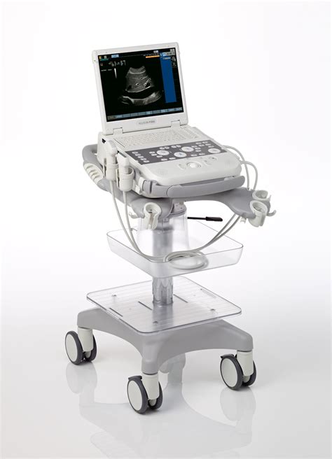 Siemens introduces Acuson P300 compact portable ultrasound system