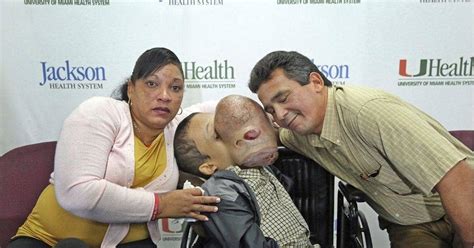 Boy with 10-Pound Facial Tumor Dies After Surgery - Plastic Surgery ...