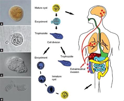 Amebiasis : Symptoms, Causes, Treatment And Prevention