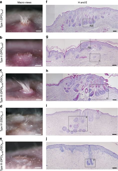 Hair-inducing ability of dermal papilla cells at passage 60 (DPCsp=60 ...