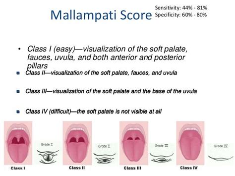 Conduct of general anesthesia