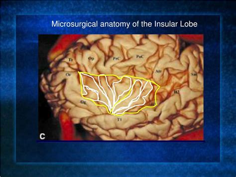 PPT - Insular anatomy After opening the temporal and fronto-parietal ...