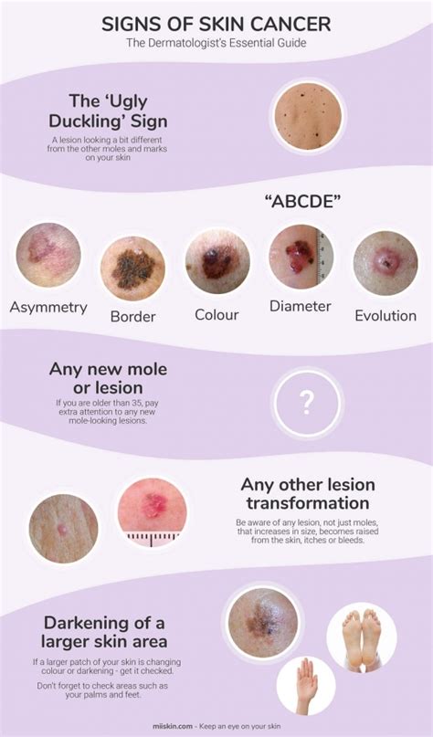 Skin Cancer Signs & Symptoms | The Dermatologist's Essential Guide