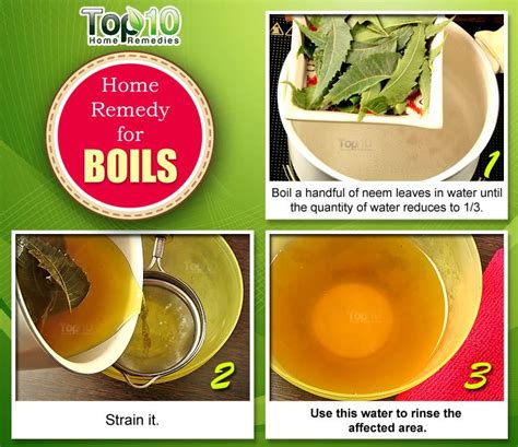 Home Remedies for Boils and Abscesses | Top 10 Home Remedies