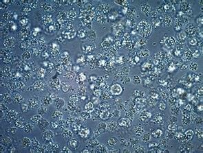 Cell Culture Contamination Troubleshooting