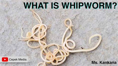 What is Whipworm | Biotechnology | General Medicine - YouTube