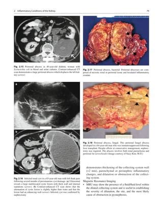 Genitourinary radiology kidney, bladder and urethra | PDF