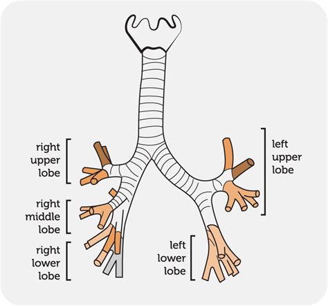 Gravity Assisted Drainage - Bronchiectasis