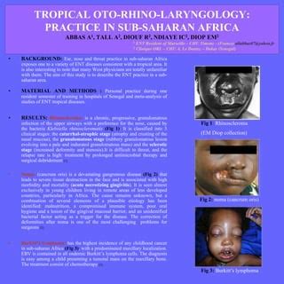 Tropical ENT MD thesis | PDF