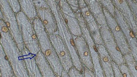 Cell Plate Definition, Formation & Cell Division - Video & Lesson ...