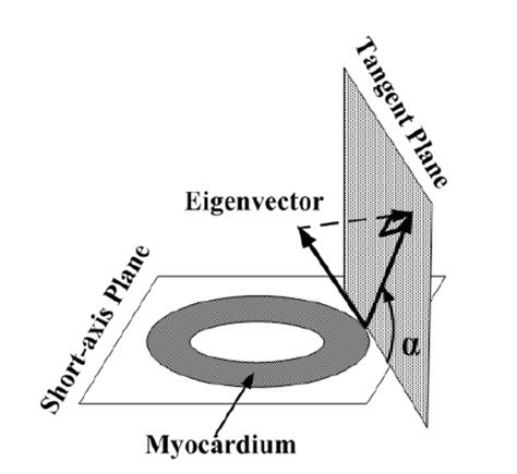 1 Definition of helix angle α . It is the angle between the image plane ...