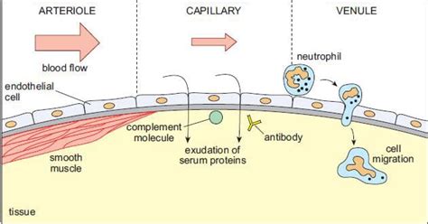 Acute Inflammation - TeachMeSurgery