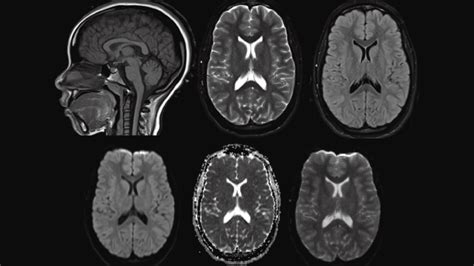 What’s The Difference Between A CAT Scan and An MRI? - Paragon Imaging