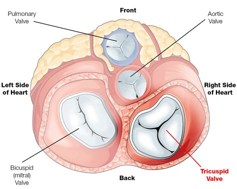 Tricuspid Valve Disease | The Patient Guide to Heart, Lung, and ...