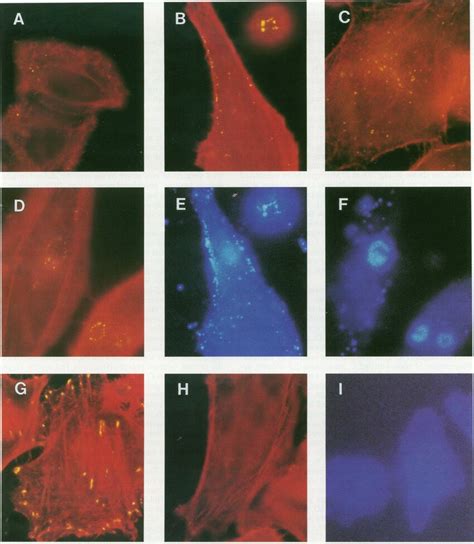 Immunofluorescence microscopy. All samples were triple labelled with ...