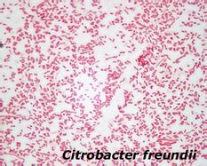 Citrobacter - Microbiology Laboratory Turkey