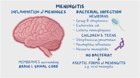 Meningitis (pediatrics): Clinical sciences - Osmosis Video Library