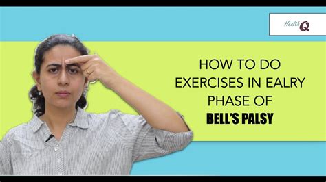 FACIAL EXERCISES IN EARLY PHASE OF BELL'S PALSY - YouTube