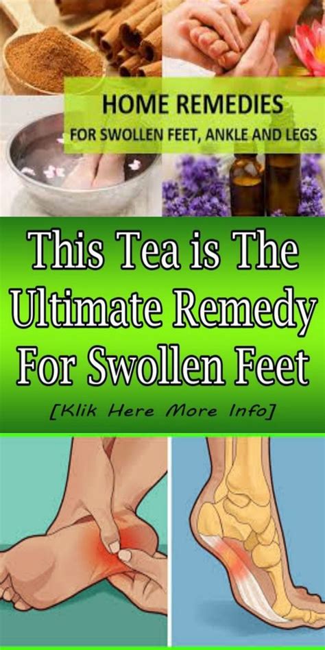 Home Remedies for Swollen FeetSwollen feet can be concerning and even ...