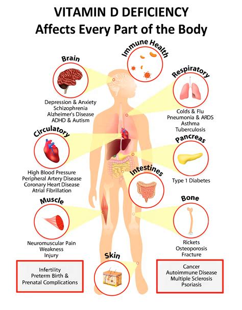 Interactive PDF: How Vitamin D Deficiency Affects Every Part of the ...