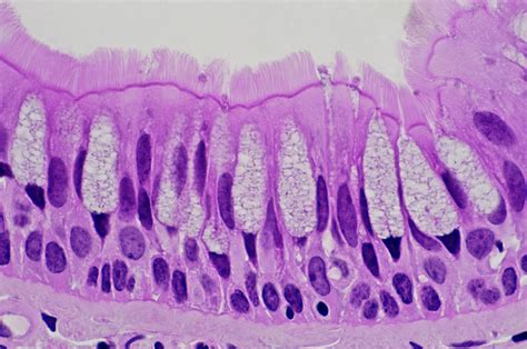 Pseudostratified Columnar Epithelium Histology