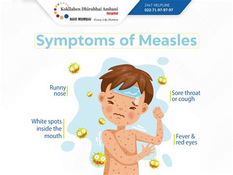 Symptoms of measles